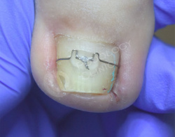 ddaf609dcbe572cddea7a7a40b9c8dd8.jpg