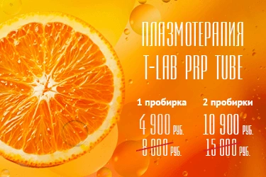 Плазмотерапия T-LAB PRP TUBE: 1 пробирка — 4 900 руб. вместо 8 000, 2 пробирки — 10 900 руб. вместо 15 000. Плазмотерапия T-LAB PRP TUBE: 1 пробирка — 4 900 руб. вместо 8 000, 2 пробирки — 10 900 руб. вместо 15 000.