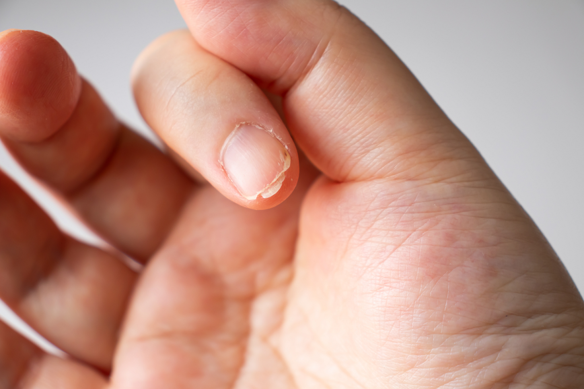 Причины, по которым могут цвести ногти на руках