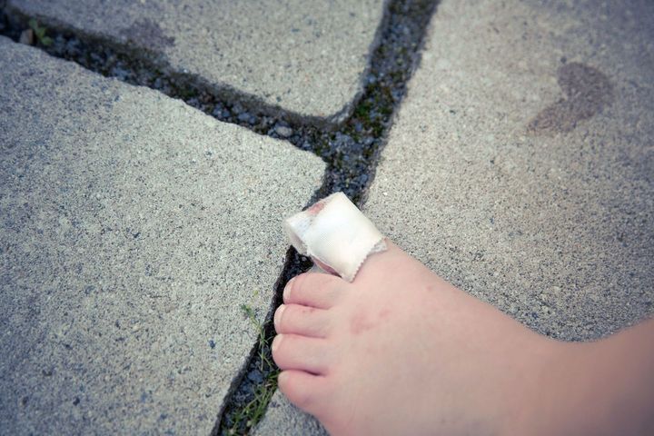 Травма на пальце ноги у ребенка