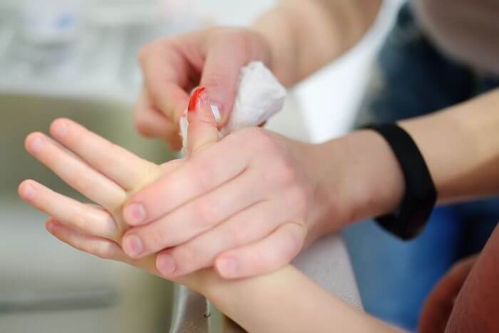 Вирус Коксаки: лечение ногтей